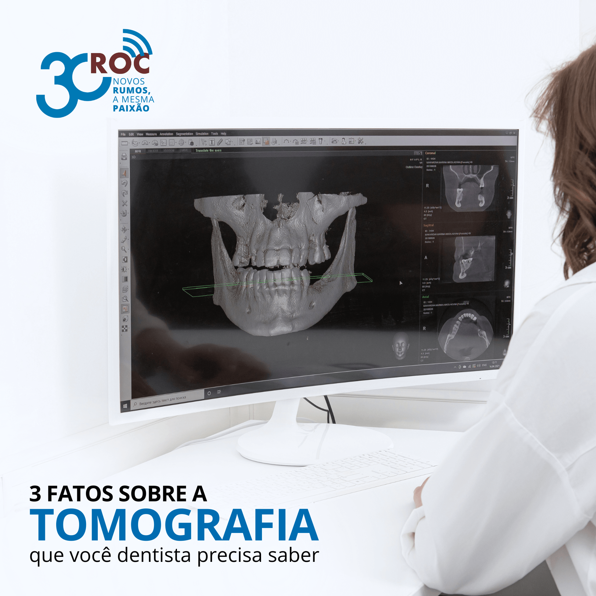 3 fatos sobre a tomografia que vocÃª dentista precisa saber