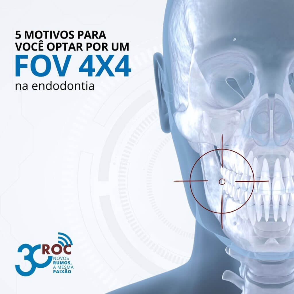 5 motivos para optar por um FOV 4x4 na endodontia
