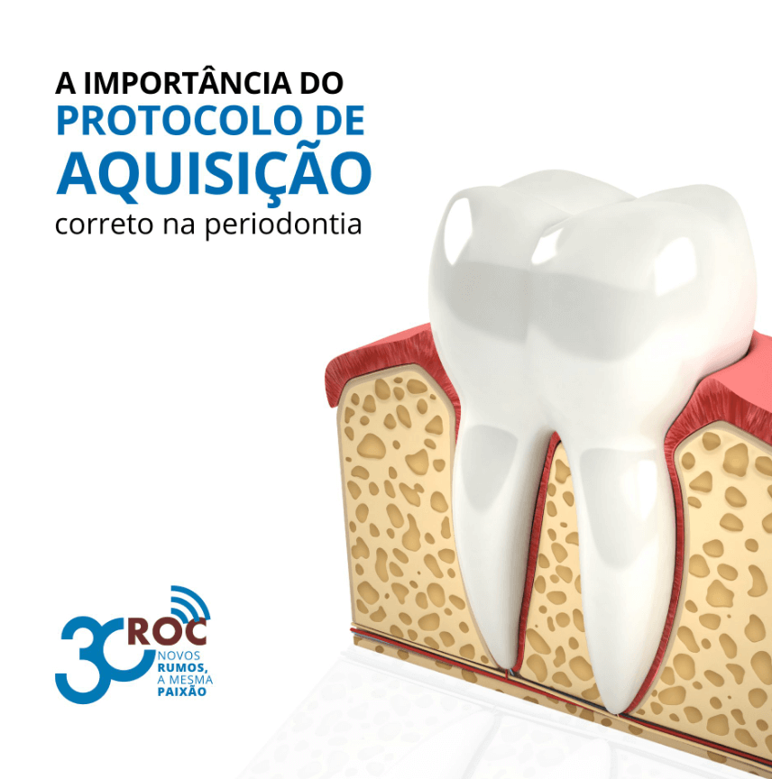 A importÃ¢ncia do protocolo de aquisiÃ§Ã£o correto na periodontia