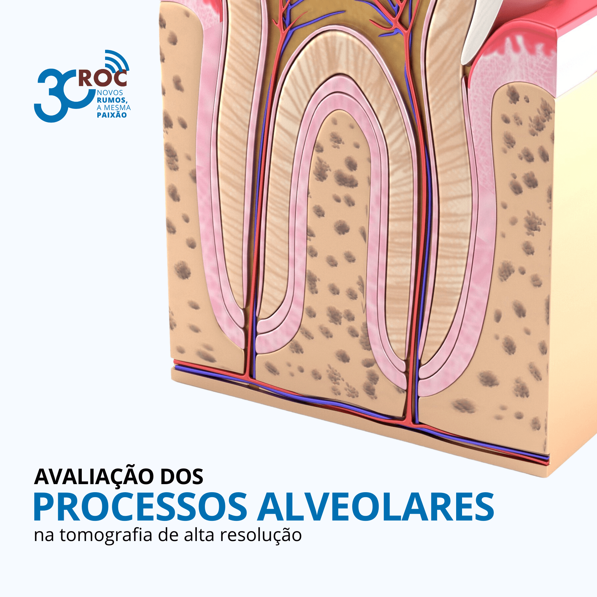 AvaliaÃ§Ã£o dos Processos Alveolares na Tomografia de Alta ResoluÃ§Ã£o