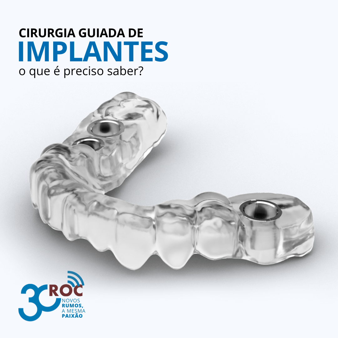 Cirurgia Guiada de Implantes â€“ O Que Ã‰ Preciso Saber?