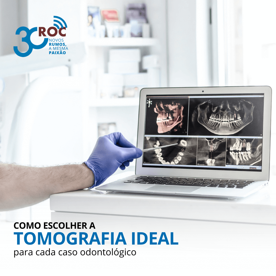 Como Escolher a Tomografia Ideal