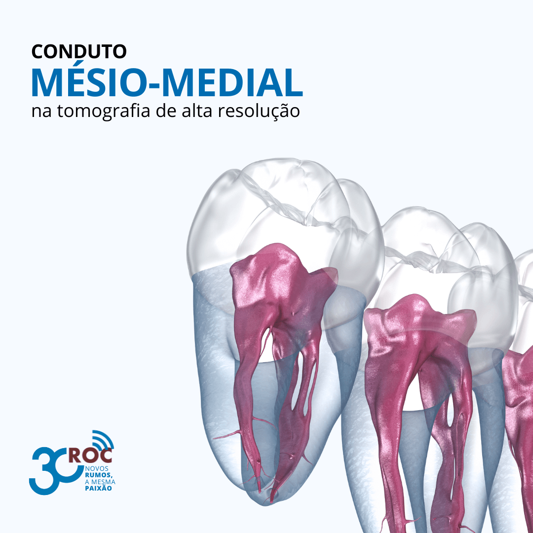 Conduto MÃ©sio-Medial