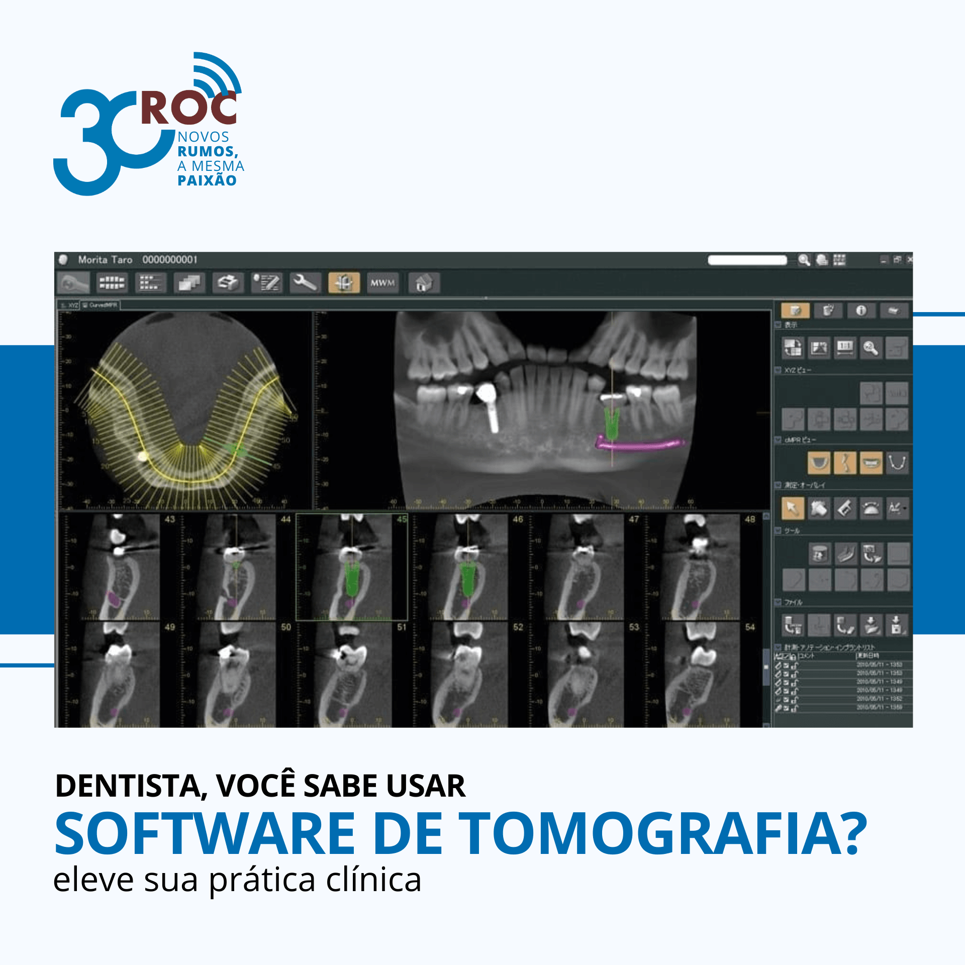 Dentista, vocÃª sabe usar o software de tomografia?
