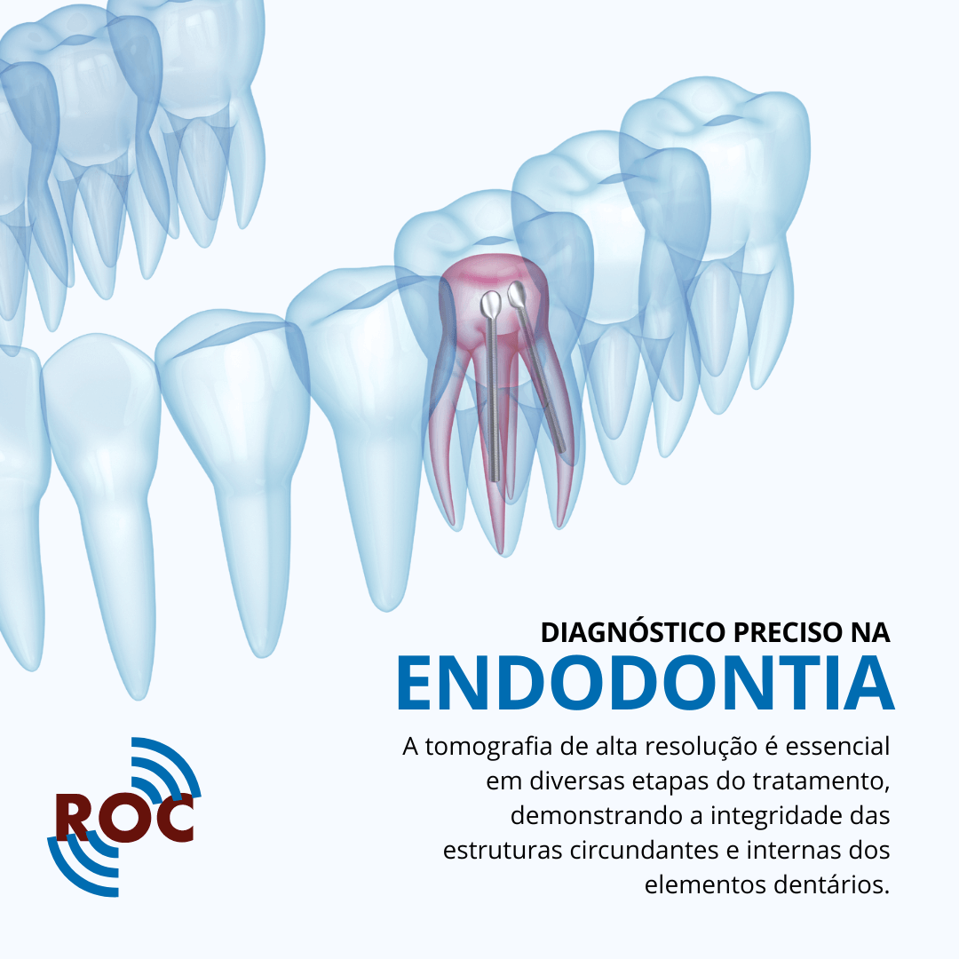 DiagnÃ³stico Preciso na Endodontia
