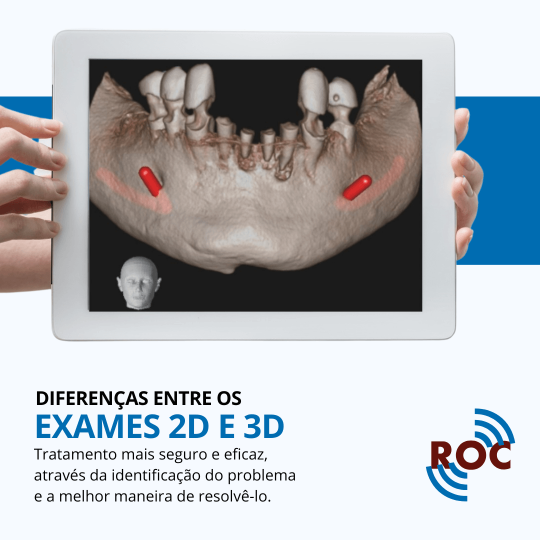 DiferenÃ§as Entre Exames 2D e 3D