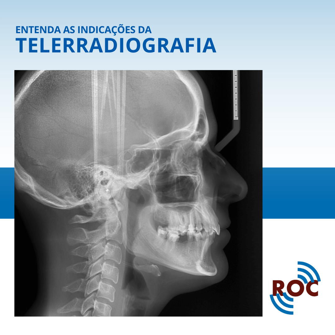 Entenda as IndicaÃ§Ãµes da Telerradiografia