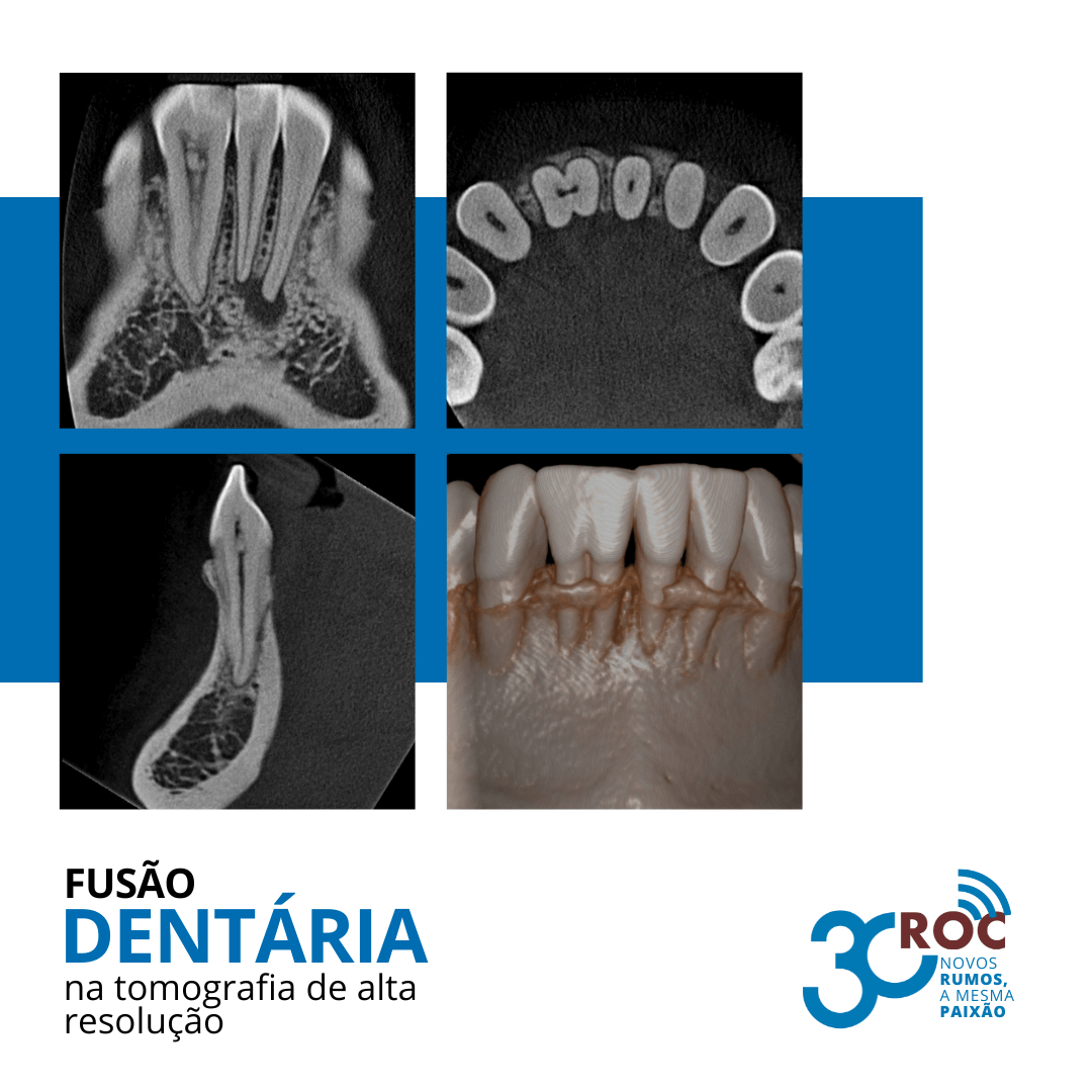 FusÃ£o DentÃ¡ria