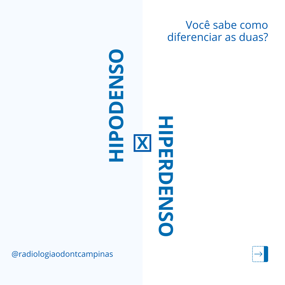 Hipodenso x Hiperdenso