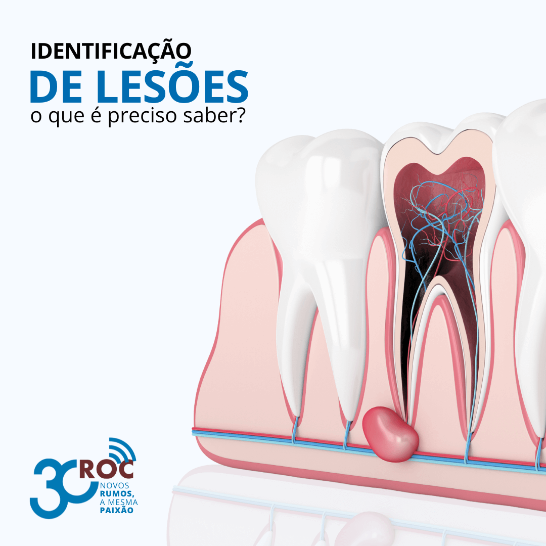 IdentificaÃ§Ã£o de LesÃµes: O Que Ã‰ Preciso Saber?