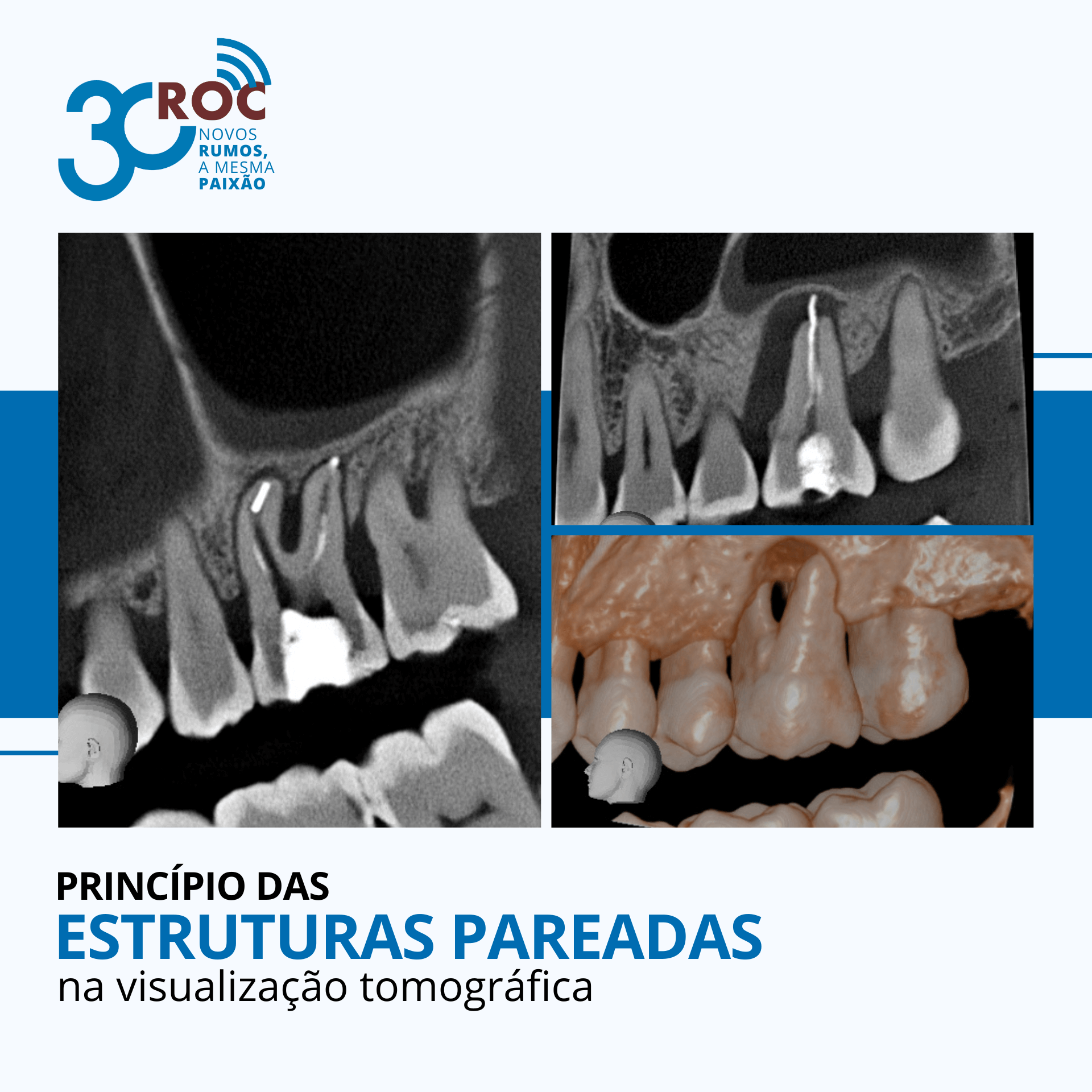 PrincÃ­pio das estruturas pareadas na visualizaÃ§Ã£o tomogrÃ¡fica