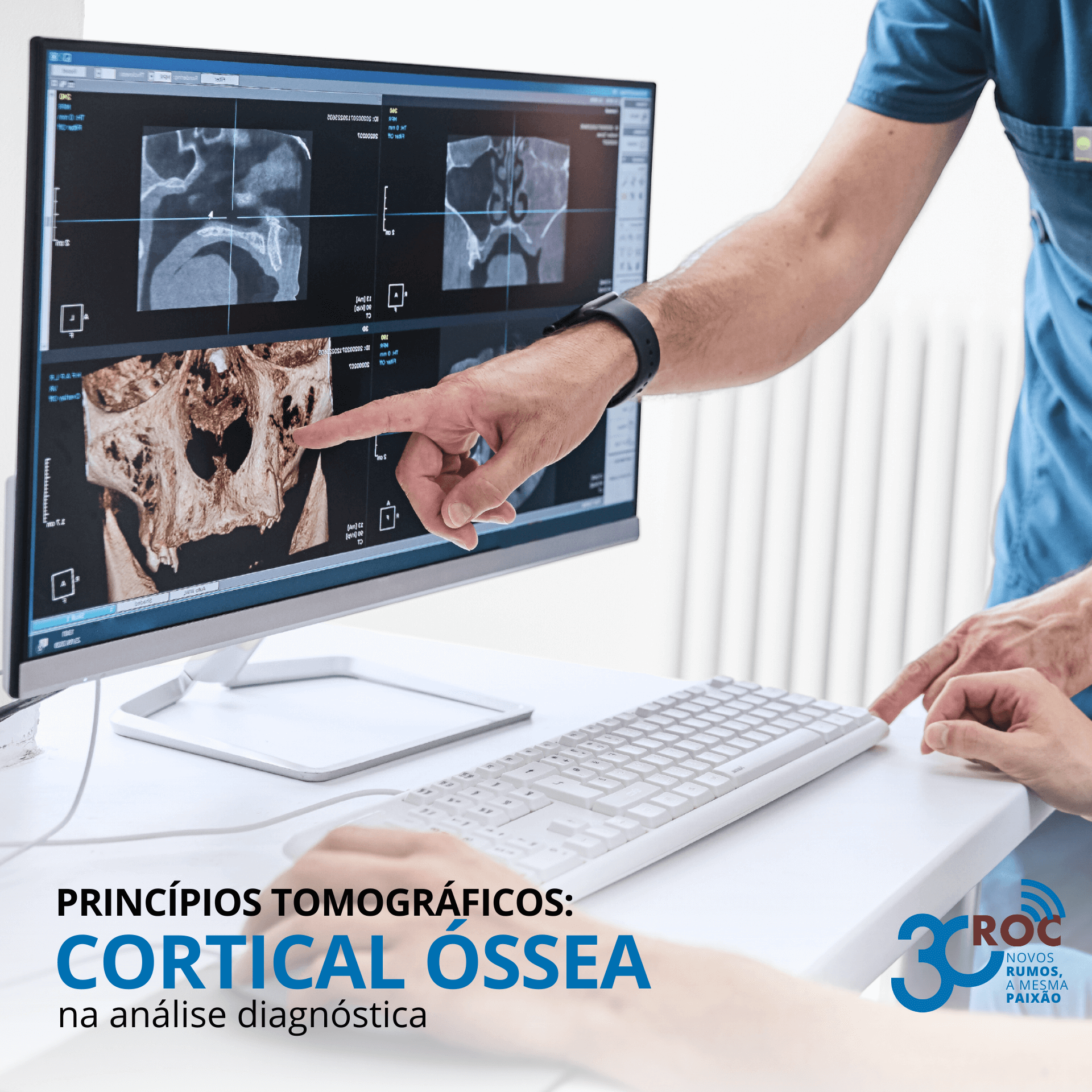 PrincÃ­pios tomogrÃ¡ficos: a cortical Ã³ssea na anÃ¡lise tomogrÃ¡fica