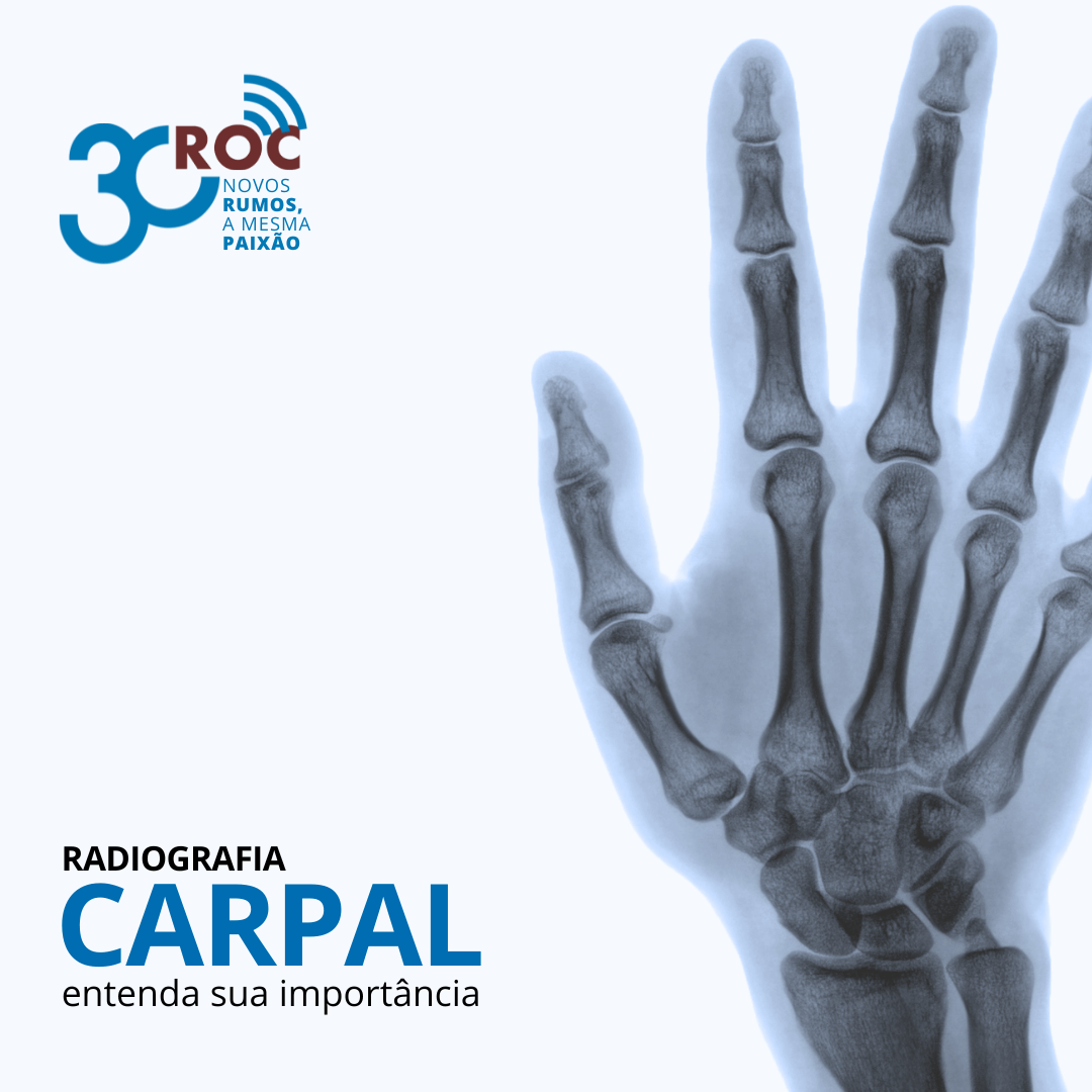 Radiografia Carpal: Entenda Sua ImportÃ¢ncia