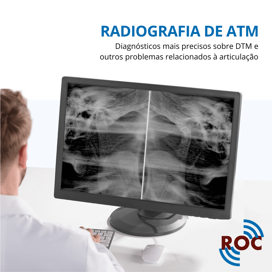 Radiografia de ATM