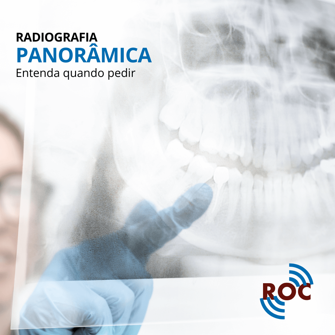 Radiografia PanorÃ¢mica: Entenda Quando Pedir