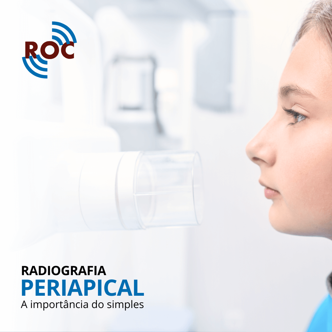 Radiografia Periapical: A ImportÃ¢ncia do Simples