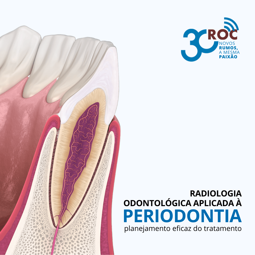 Radiologia OdontolÃ³gica Aplicada Ã  Periodontia