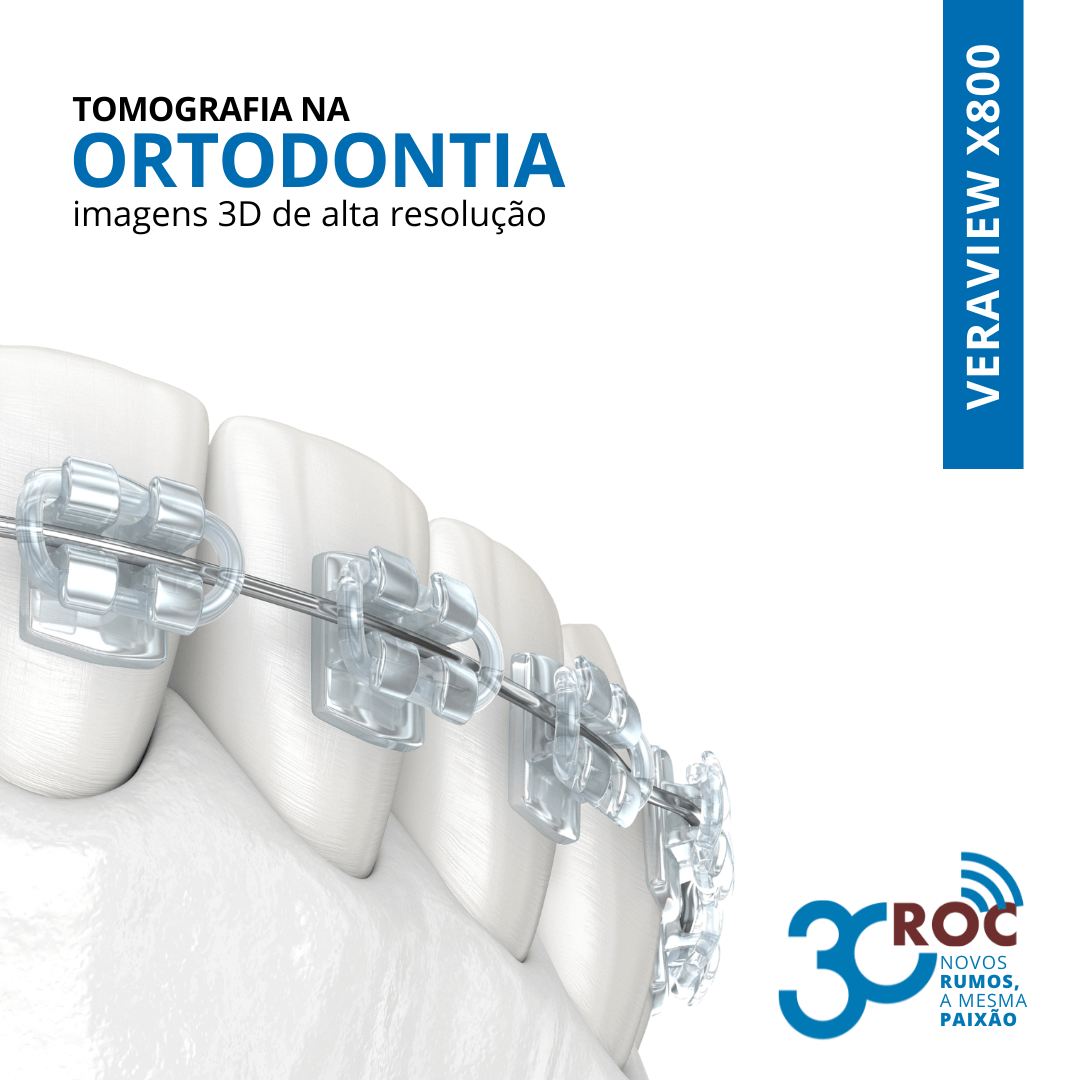 Tomografia na Ortodontia